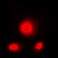 ATXN1 / SCA1 Antibody (C-Terminus)
