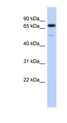 Polyclonal Rabbit anti-Human DMTF1 Antibody (aa611-660, WB)