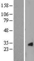 CRYGS Protein (Over-Expression Lysate Myc-DDK (Flag))