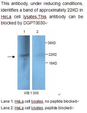 Polyclonal Rabbit anti-Human PDCD6 / ALG-2 Antibody (WB)