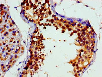 VCP Antibody