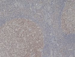 Monoclonal Mouse anti-Human MCM2 Antibody (clone CRCT2.1, IHC, WB)