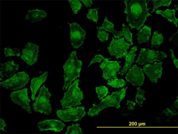 Rho Kinase / ROCK1 Antibody (clone 2E2)