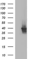 Apolipoprotein A-V Antibody (clone OTI1A2)