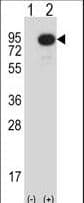 MAP3K2 / MEKK2 Antibody (aa14-43)