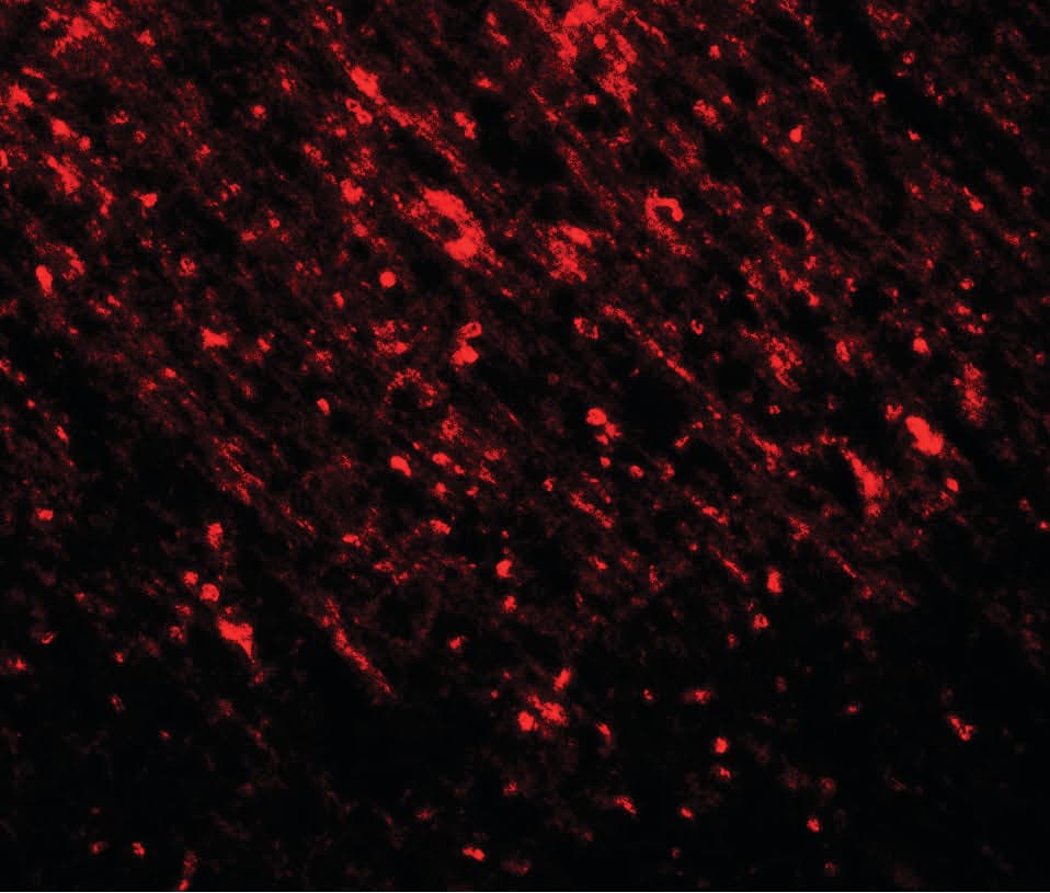 IHC-plus™ Polyclonal Rabbit anti-Human TLX2 / NCX Antibody (IHC, IF, WB)