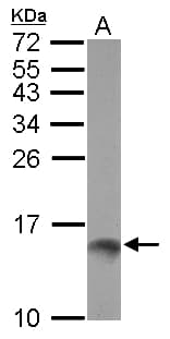 TFF1 / pS2 Antibody