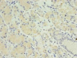 Polyclonal Rabbit anti-Human MIS12 Antibody (aa1-305, IHC, WB)