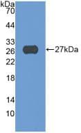 ADAM17 / TACE Antibody (aa226-473)