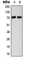 XRCC6 / Ku70 Antibody (C-Terminus)