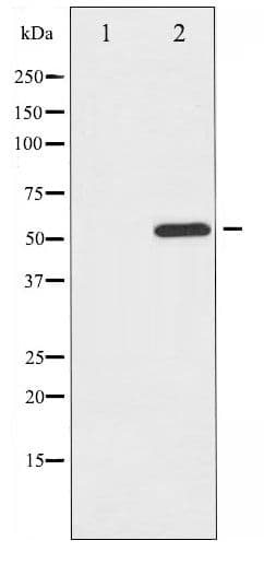 MITF Antibody (phospho-Ser180/73)