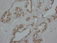 PRKCA / PKC-Alpha Antibody (C-Terminus)