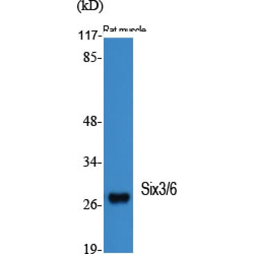 SIX3 + SIX6 Antibody (90-170 aa, Internal)