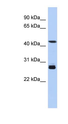 SYT9 / Synaptotagmin 9 Antibody (aa179-228)