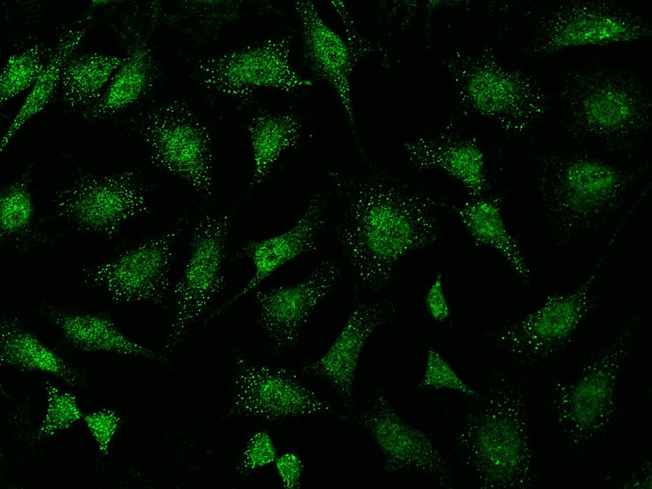 ABI2B / ABI2 Antibody (Preservative Free)
