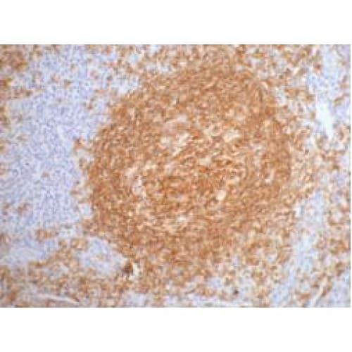 Monoclonal Mouse anti-Human CD20 Antibody (clone 2F4, IHC)