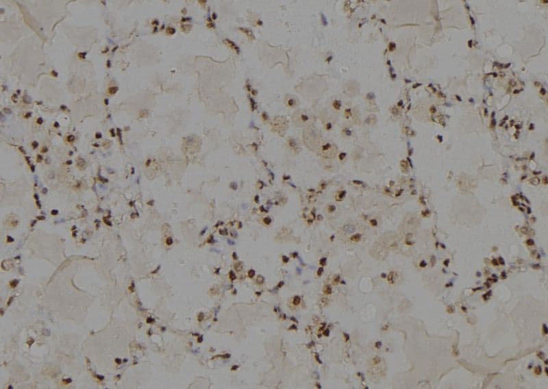ABCC13 Antibody