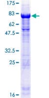 Human TSSC1 Protein (Recombinant GST)