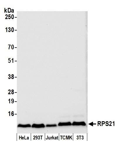 RPS21 / Ribosomal Protein S21 Antibody (aa1-50)