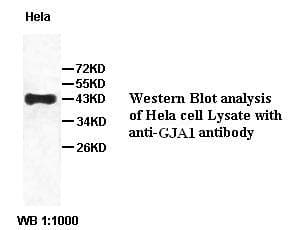 Polyclonal Rabbit anti-Human GJA1 / CX43 / Connexin 43 Antibody (IHC, WB)