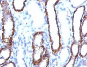 CDH16 / Cadherin 16 Antibody (clone KSCP2)