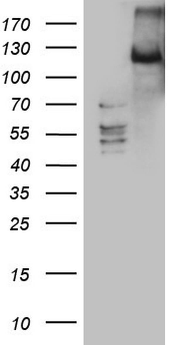 LATS2 Antibody (aa1-237, clone OTI2D3)