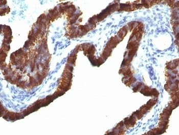 KRT7 / CK7 / Cytokeratin 7 Antibody (clone KRT7/760 + OV-TL12/30)