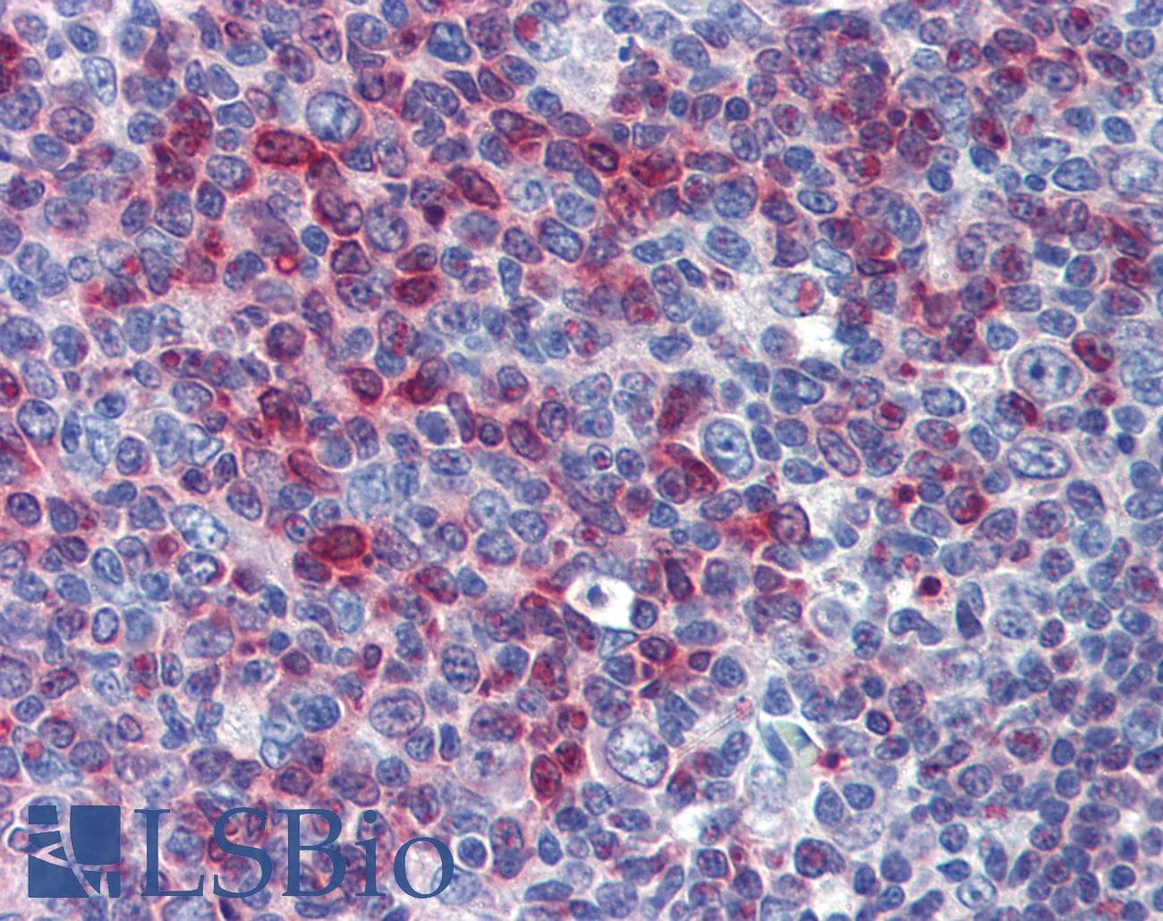 IHC-plus™ AKIRIN1 Antibody
