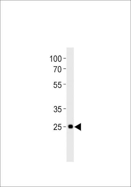 dlx6a Antibody (aa 167-194, C-term)