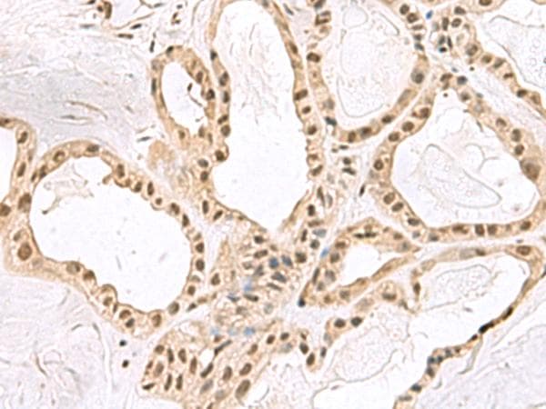 PCNA-Associated Factor Antibody