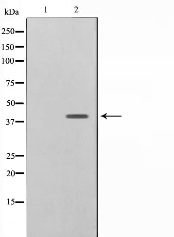 Polyclonal Rabbit anti-Human CBX6 Antibody (IF, WB)