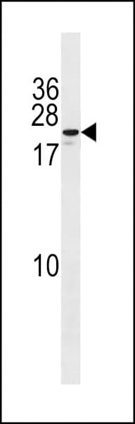 ZNF580 Antibody (aa91-119)