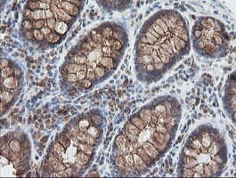 UBE2G2 Antibody (clone OTI1D7)