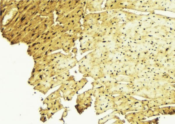 AR / Androgen Receptor Antibody