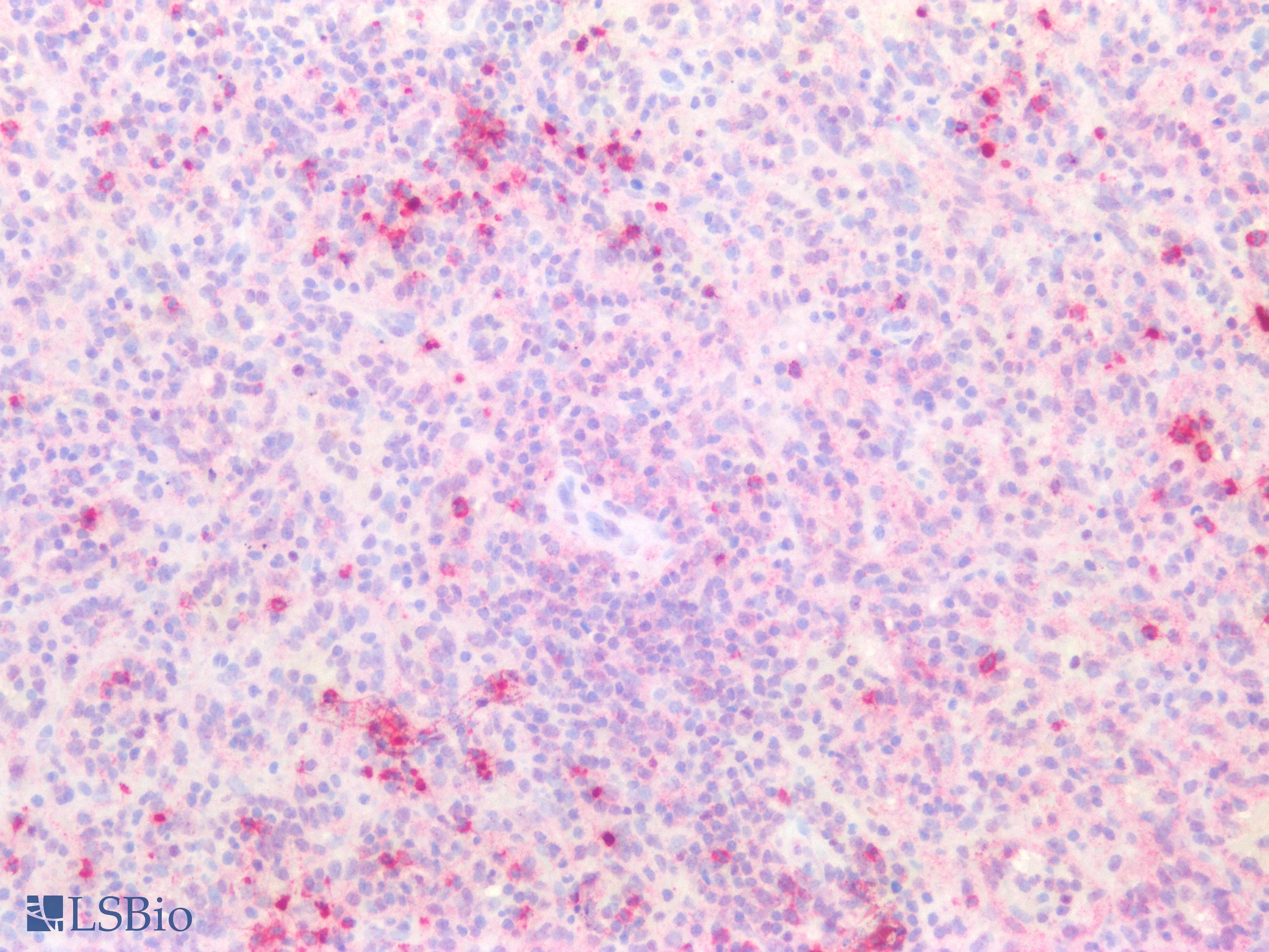 PathPlus™ Polyclonal Rabbit anti-Human LCN2 / Lipocalin 2 / NGAL Antibody (IHC, IF, WB)