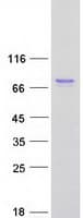 Human TRIM47 Protein (Recombinant Myc-DDK (Flag))
