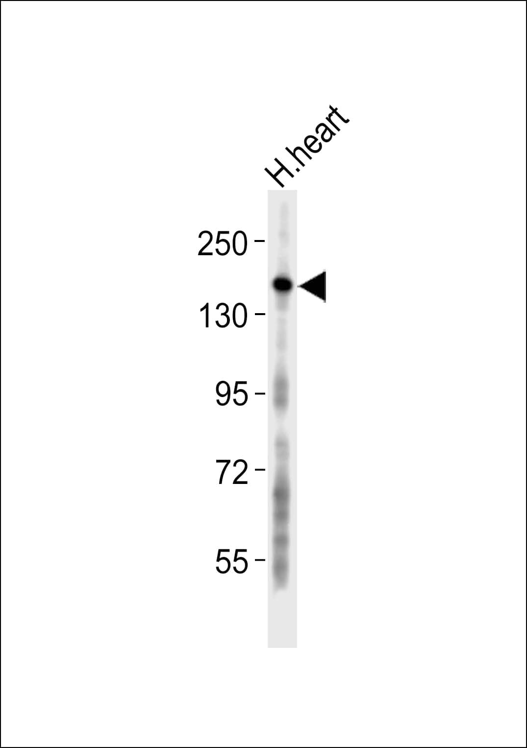 COL5A3 / Collagen V Alpha 3 Antibody