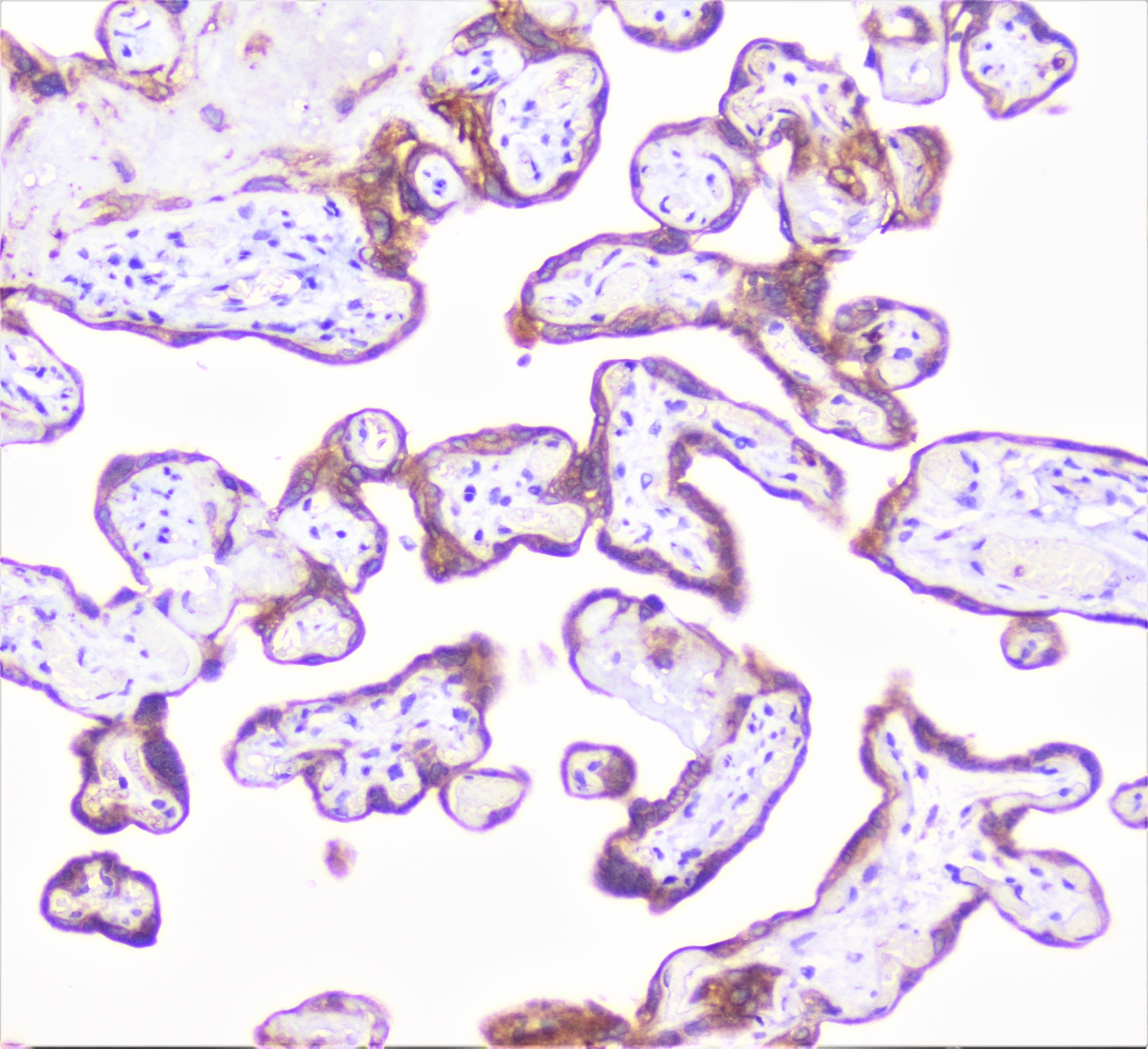 COMP / THBS5 Antibody
