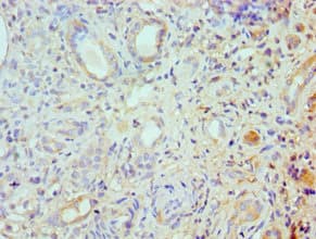 ROCK2 Antibody (aa1109-1388)