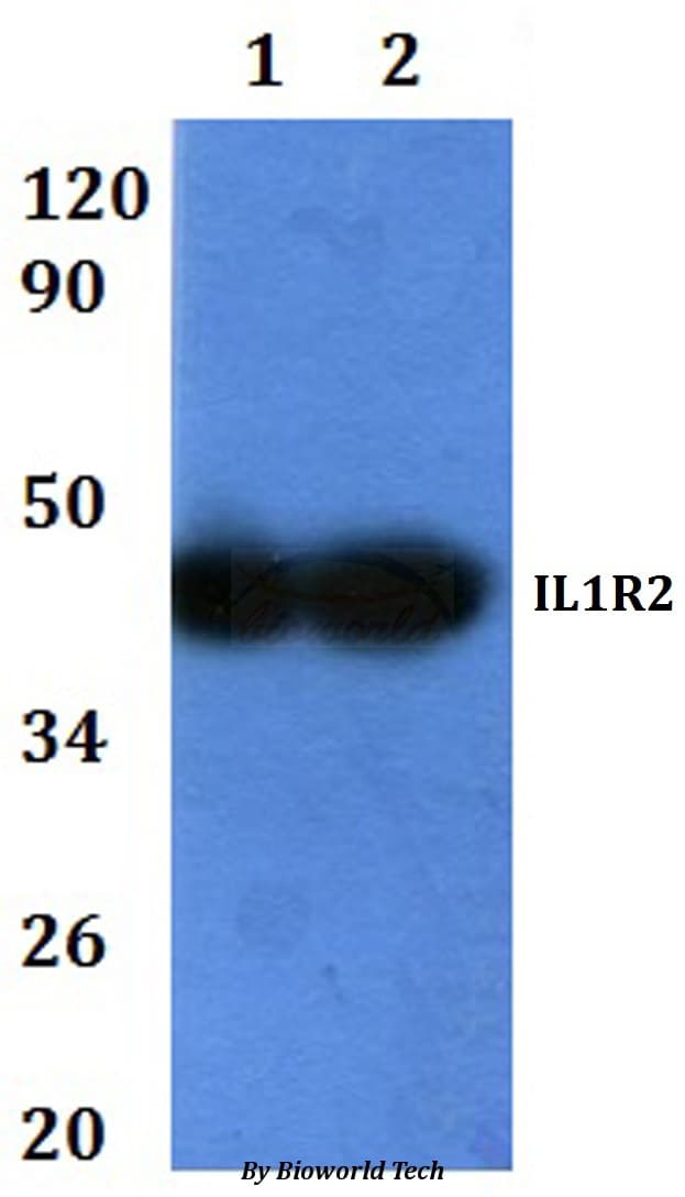 Polyclonal Rabbit anti-Human CD121b / IL1R2 Antibody (WB)