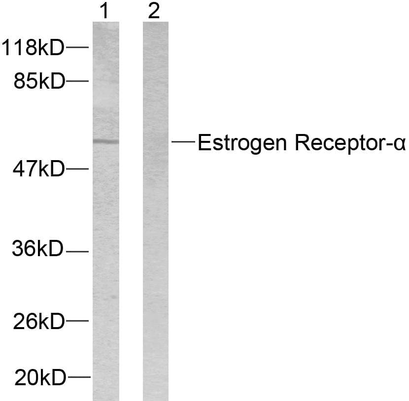 ER Alpha / Estrogen Receptor Antibody (p104)