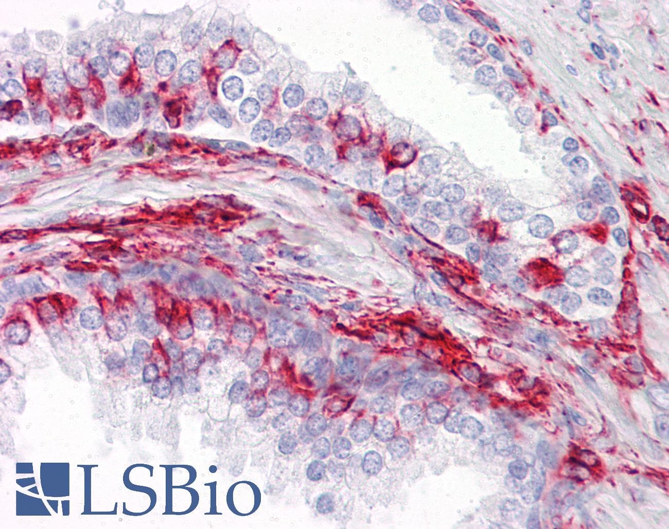 PathPlus™ Vimentin Antibody (clone RV202)