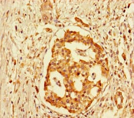 Polyclonal Rabbit anti-Human GPR183 / EBI2 Antibody