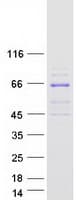 Human PIKFYVE / PIP5K Protein (Recombinant Myc-DDK (Flag))