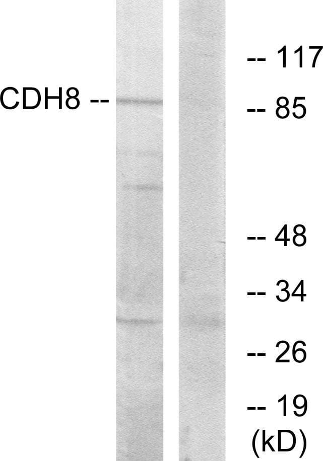 CDH8 / Cadherin 8 Antibody
