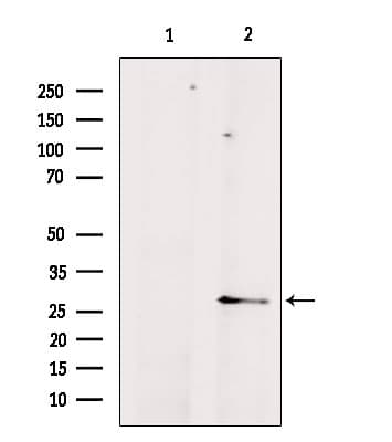 AQP8 / Aquaporin 8 Antibody