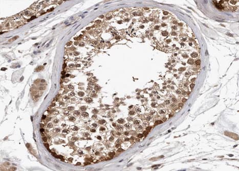HSP90AA1 / Hsp90 Alpha A1 Antibody