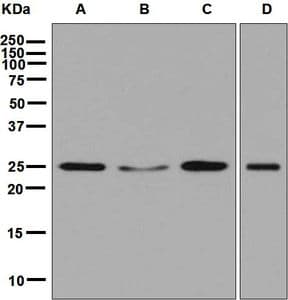 IHC-plus™ Monoclonal Rabbit anti-Human RALA / RAL Antibody (clone EPR6468, Internal, IHC, WB)