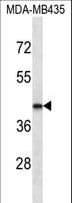 LHX2 Antibody