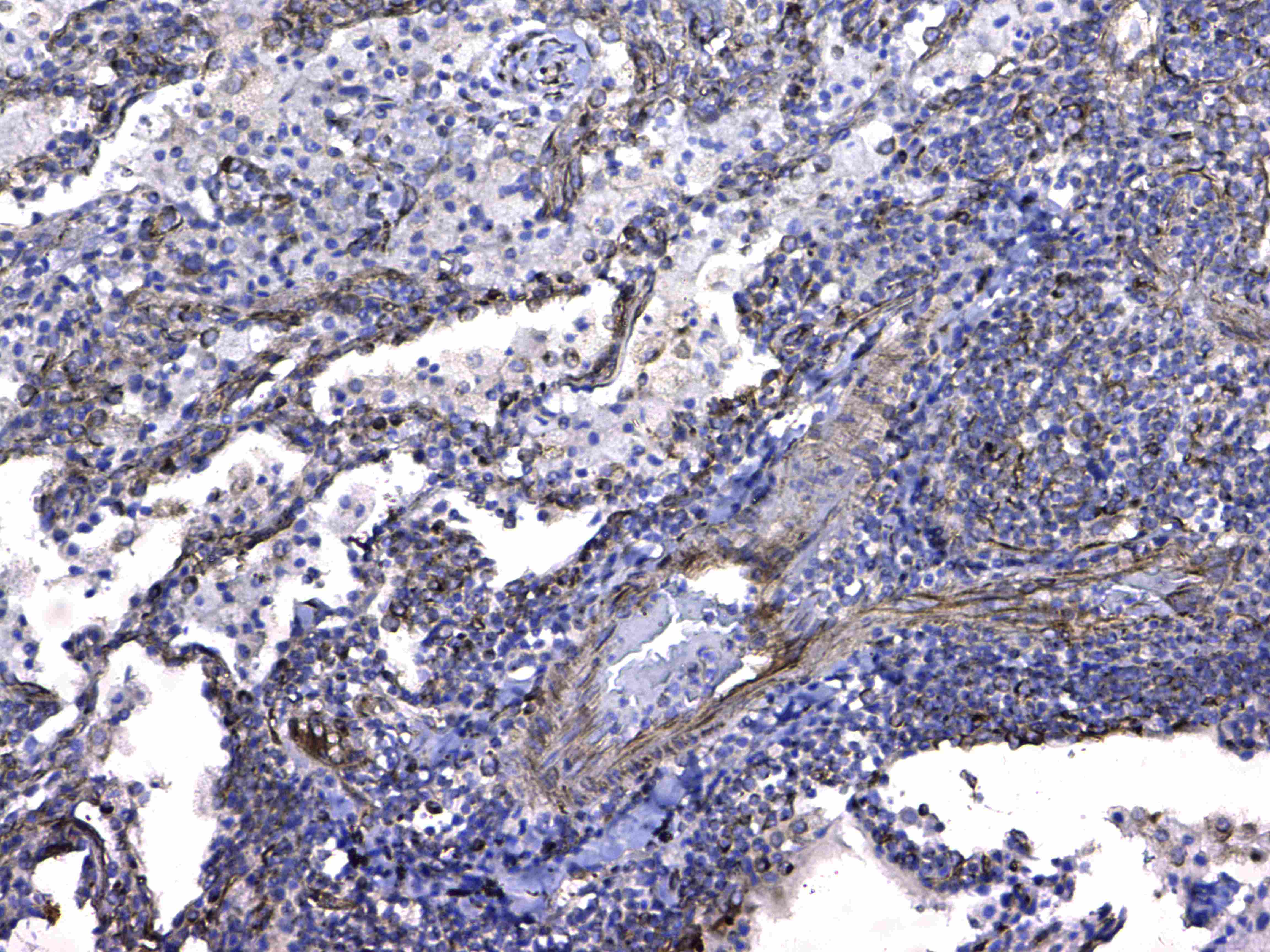 GSTM3 Antibody